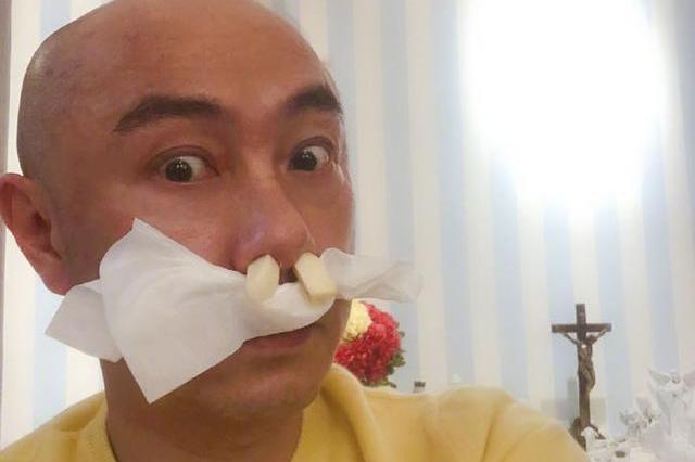 张卫健鼻子过敏,听妈妈话把大蒜塞鼻子里,结果成了这样