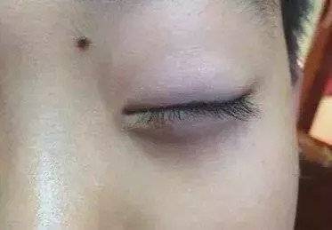「舌苔」捏积派——孩子脾胃好不好?除了看舌苔眼袋颜色也能帮你判断