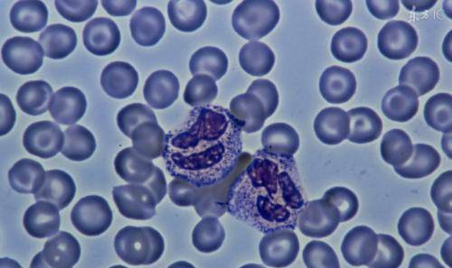 如何知道自己的体内有癌细胞 c2a1b256015f4284bb8e36d49e982703.jpeg