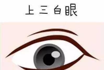 什么叫三白眼四白眼 1dbb63cde56147e38e36f62174a27d44.jpeg