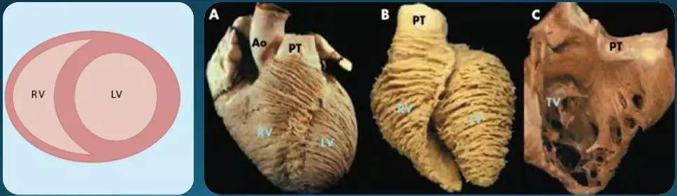 超声心动图十大基本功6.1:右心室解剖特点