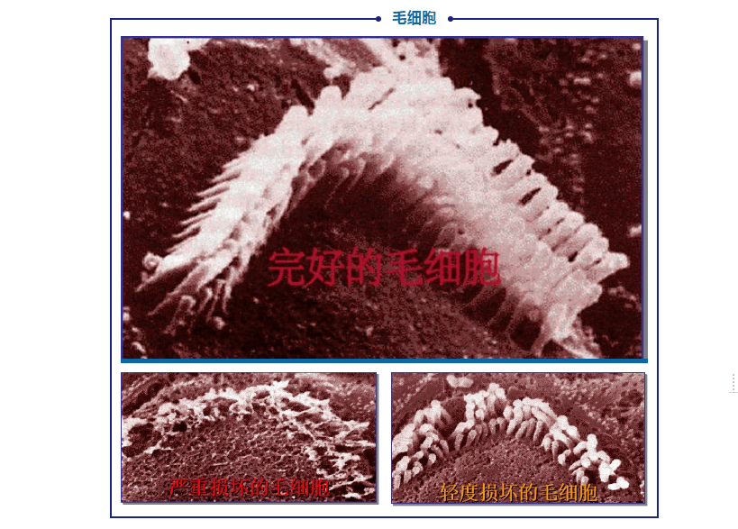 预防老年性聋平时要特别关注这几种相关疾病