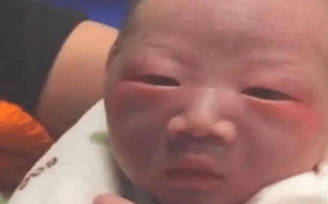 「小宝宝」医生却说很好看,满月后见分晓新生儿因太“丑”遭全家嫌弃