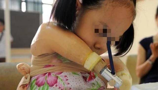原创孕妇被告知胎儿“四肢全无”，坚持生下后，现在咋样了？