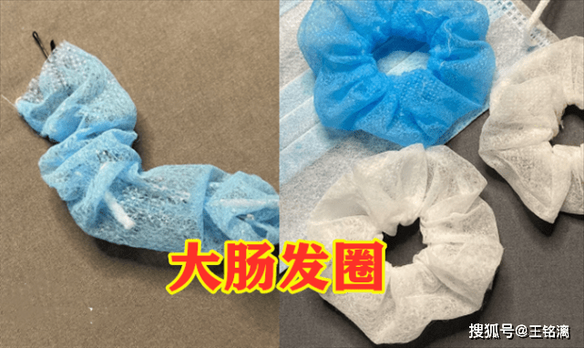 最近"废弃口罩"很流行?大肠发圈vs戒指,看到手机壳:爱