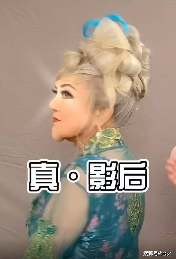 曾以瓜子脸著称，后因60元整容针险丧命，影后近
