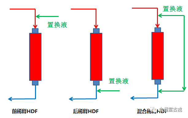 血液透析滤过是什么原理_血液透析滤过的原理图