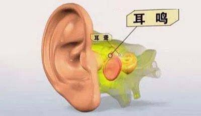 什么原因导致脾胃失调 4e43f300476e4da78c554dde7f9baba3.jpeg