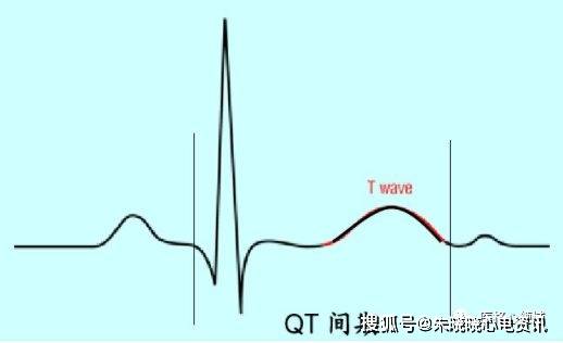 正常心电图波形及临床意义