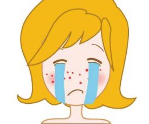 改善痘印,可靠的4个小招式,效果或能让你满意