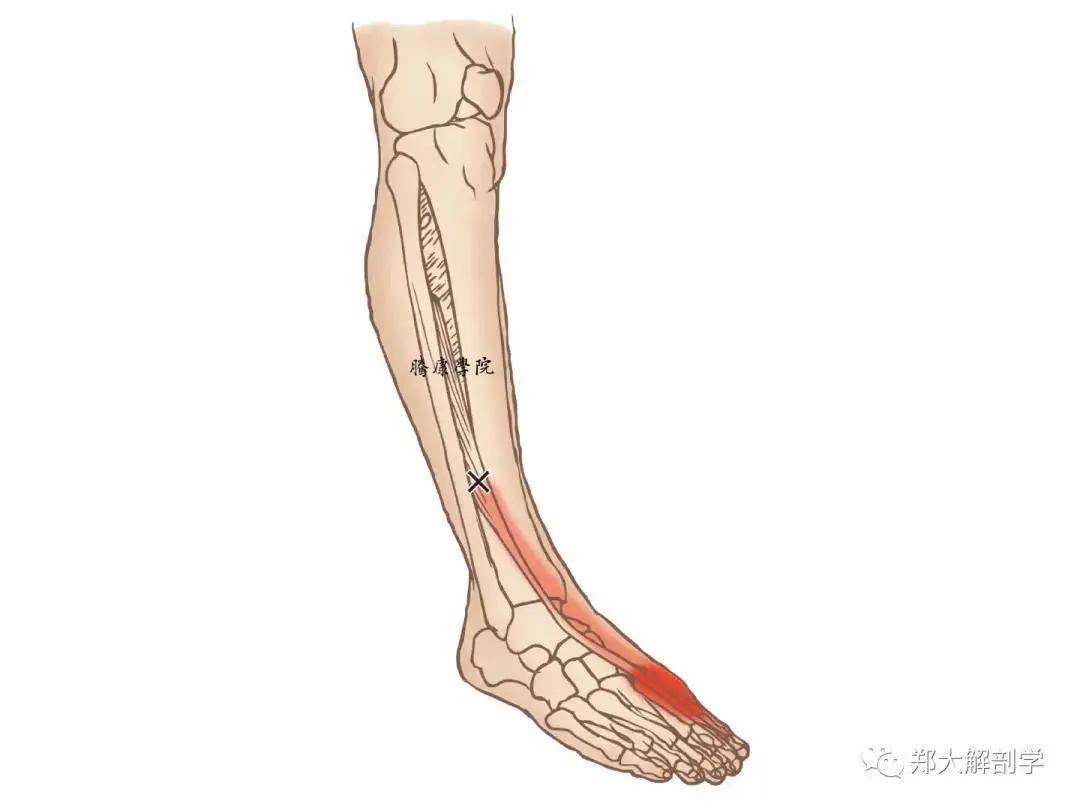腓骨长短肌病因:腓骨长短肌的扳机点常因为急性或慢性的肌肉过度使用