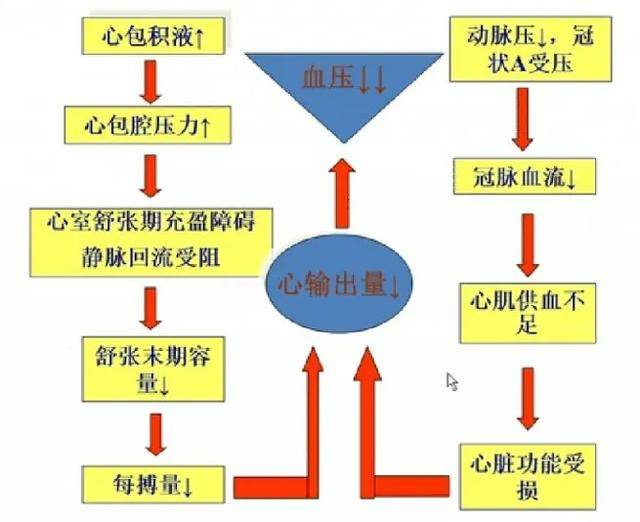 病例分享丨张加强教授利用床旁即时超声协助pacu低血压原因一例