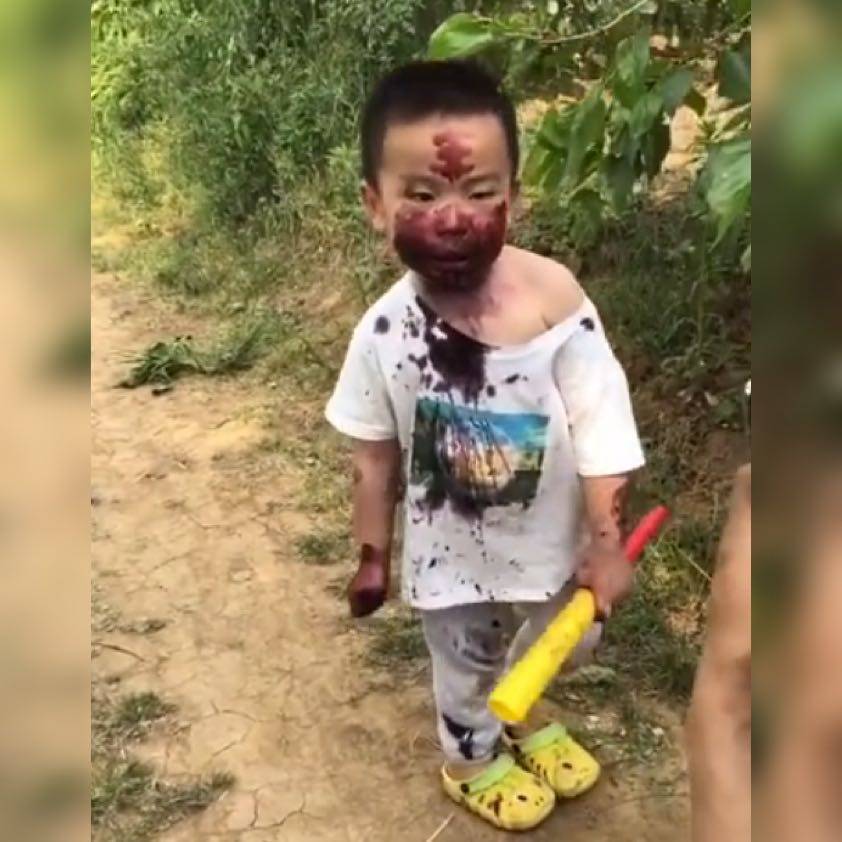 原创萌娃摘桑葚，搞了一张纯天然“桑葚面膜”火了，网友：妈见打系列