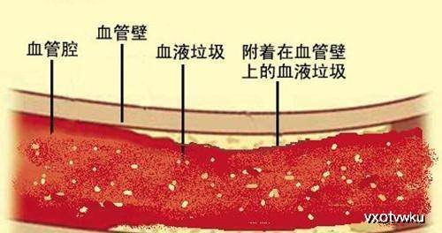 a497a556fa064fd79584f8d4d86495ab.jpeg