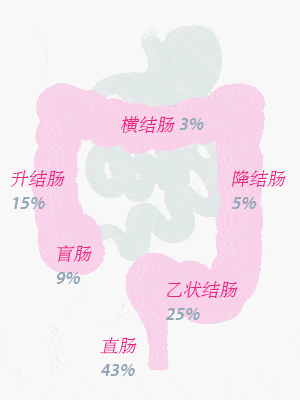 根据图片可见,直肠和乙状结肠部位是整个大肠中最有可能患癌症的地方