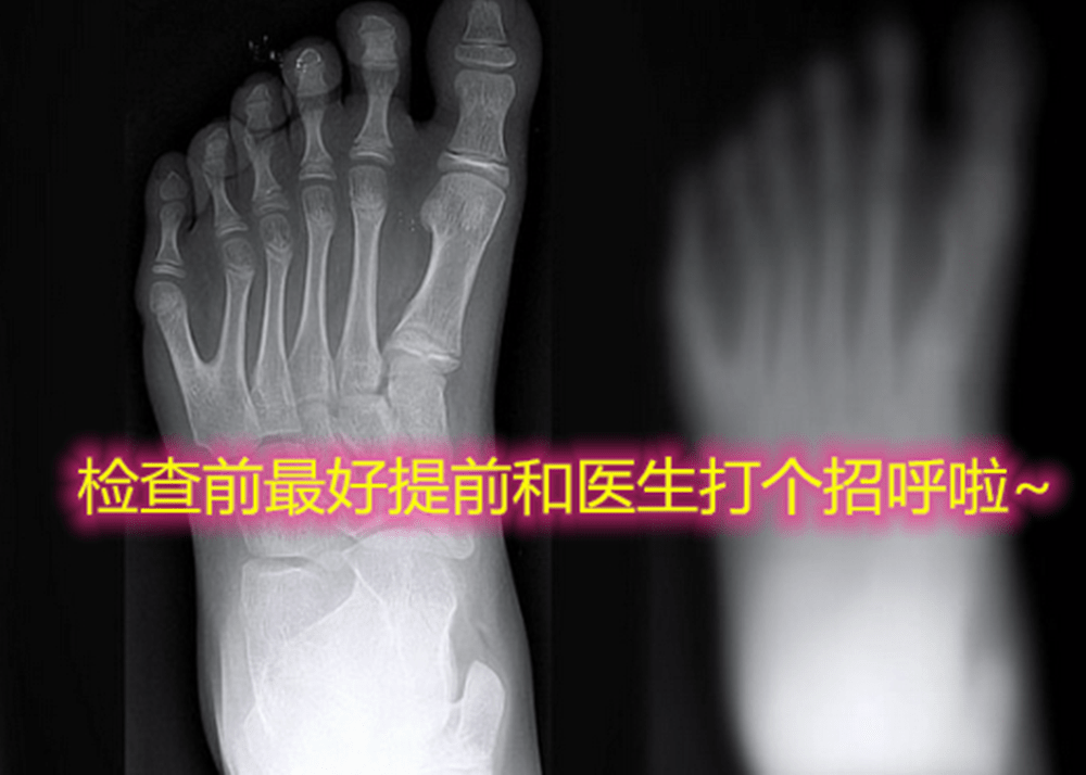 双脚|15人双手双脚皆六指，网友：结婚戒指戴哪巴西“六指琴魔”家族