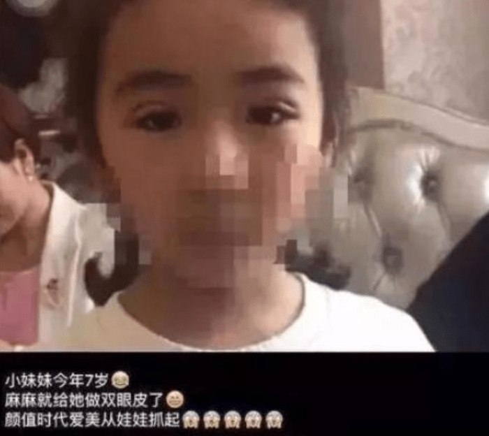 孩子|看似是为了爱美，实际是为了根治倒睫！宝妈给7岁女儿割双眼皮