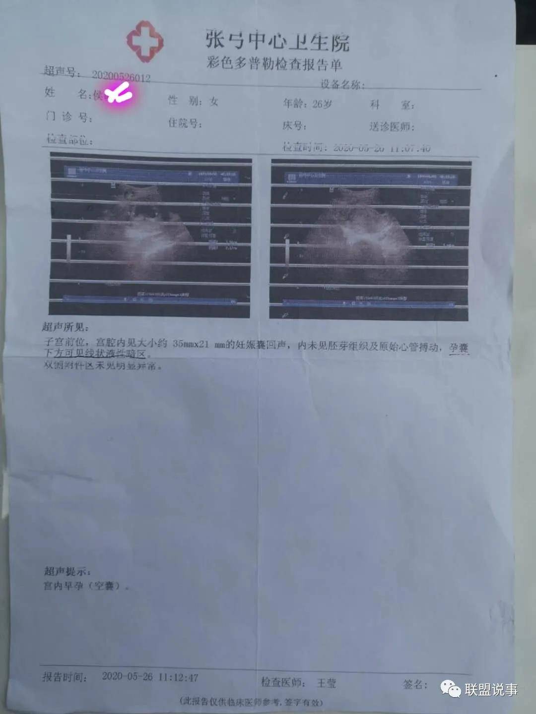 河南省宁陵县张弓镇人口_宁陵县张弓镇北村张强(2)