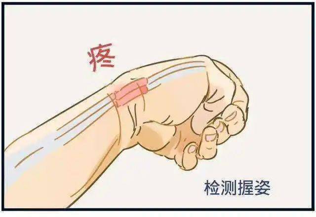 若大拇指一侧手腕部位出现疼痛,则多数为腱鞘炎所致