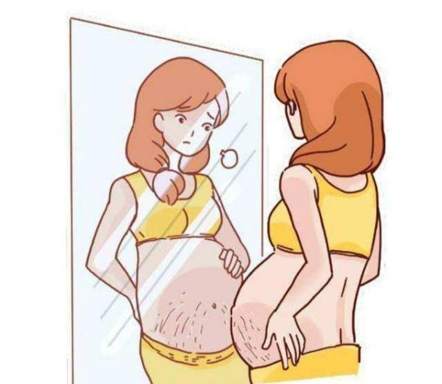 怀孕后期妊娠纹怎么办