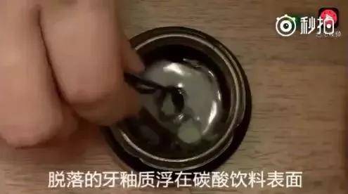 可乐好喝,但腐蚀的牙齿可真是触目惊心啊