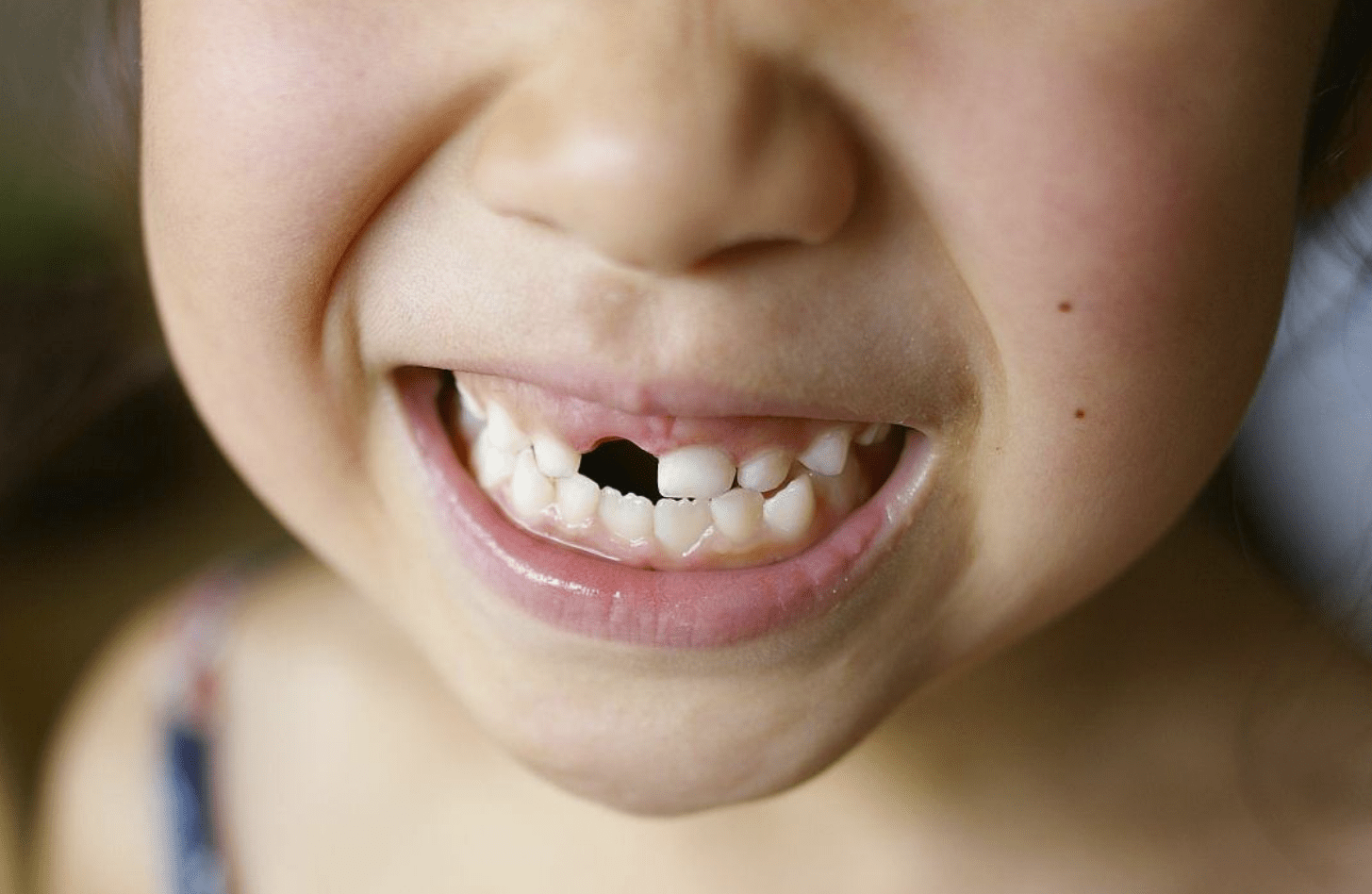 牙齿发黑是怎么回事教你如何解决（造成孩子"满口黑牙"的并不是糖果，而是家里这3样东西，你有吗） | 说明书网