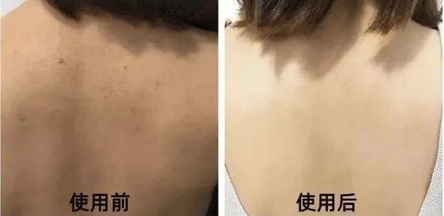 身上皮肤光滑什么命 皮肤光滑=好命？千年面相学VS现代科学，真相令人深思