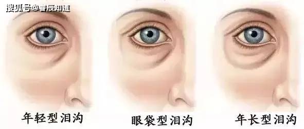 b6223bab97164103973207aeb3137e5a.jpeg