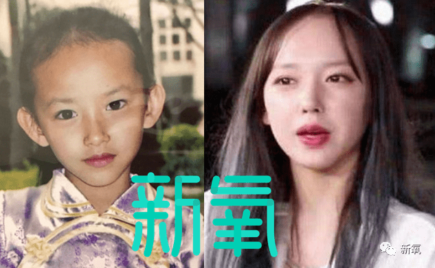 虞书欣不是才24岁吗?怎么就秃成这样了…