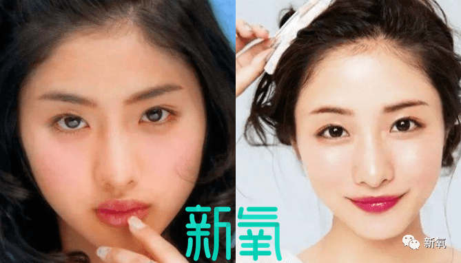 虞书欣不是才24岁吗?怎么就秃成这样了…