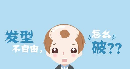 发型不自由怎么办该怎么远离脱发烦恼