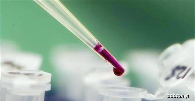 血脂怎样检查才准确 13d062061d5040b398f6a8716269b07a.jpeg