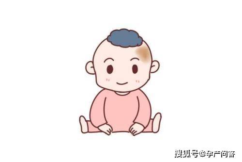 行为|早避开，以免胎儿自卑胎记是怎么形成的？孕期3种行为易造成