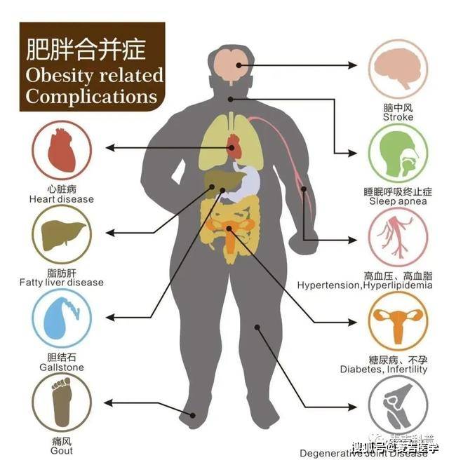 癌症,喜欢"盯上"肥胖的人?看完你就明白了_手机搜狐网