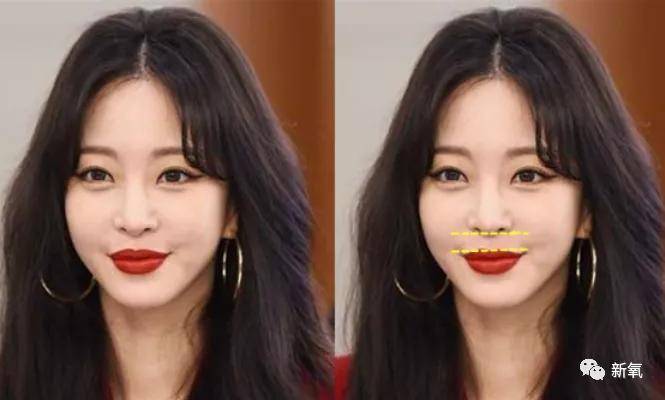 原创好歹也是娱乐圈第一代人造顶级美女,怎么也因为乱填充翻车了? 原创好歹也是娱乐圈第一代人造顶级美女,怎么也因为乱填充翻车了?