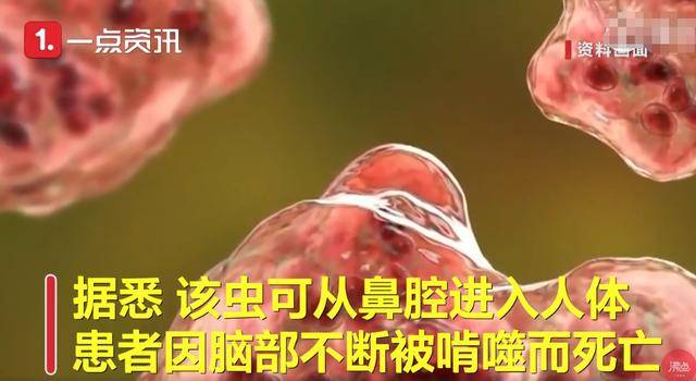 该州有一人确诊感染俗称为"食脑虫"的寄生虫