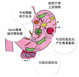 很多人本身并没有症状,只是在体检后查出幽门螺杆菌阳性后就忧心忡忡