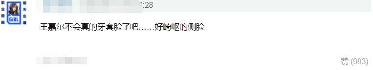 颧骨|王嘉尔变成牙套脸?颧骨外扩太阳穴也凹陷,太多明星因此颜值骤降