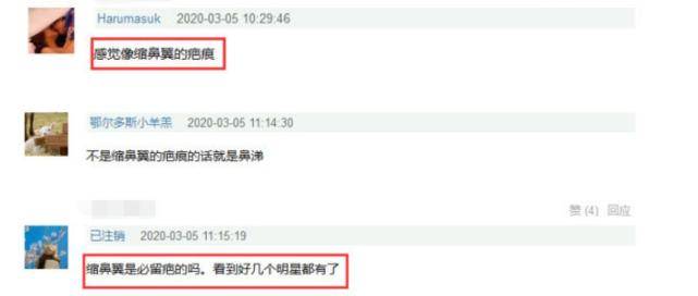 鼻尖|欧阳娜娜晒美照侧颜精致，山根鼻尖与以前差距大被质疑微调了鼻子