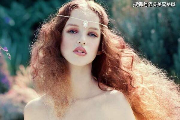 脸上的色斑怎么办