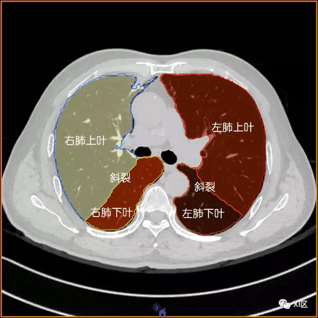 如此详细的肺部影像解剖,有点儿酷!