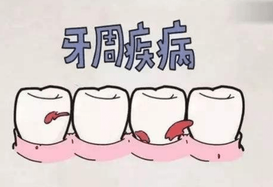 牙齿松动出血怎么办