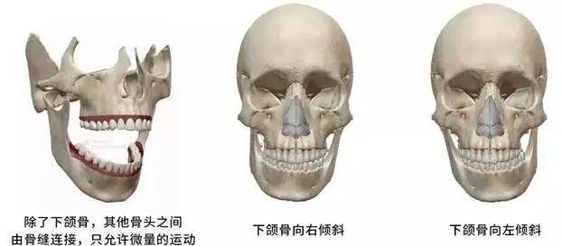 正的面部骨骼偏斜和下颌紊乱 而已经成年的人,则会影响脸部软组织大小