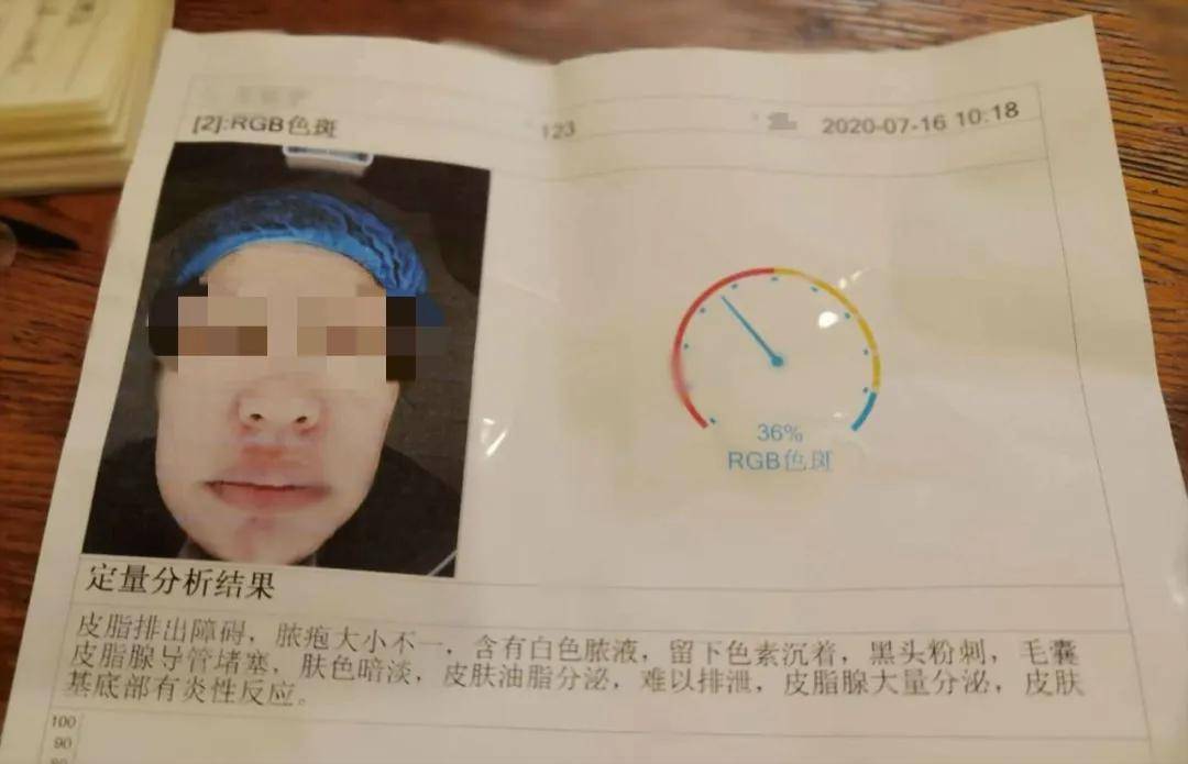 在青岛金肤康皮肤病医院砸进两万三 脸上皮肤雪上加霜还背上了美容贷