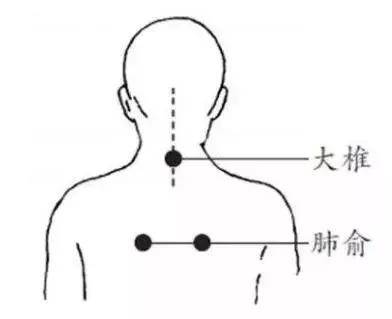 内附咳嗽,发烧感冒的刮痧疗法.