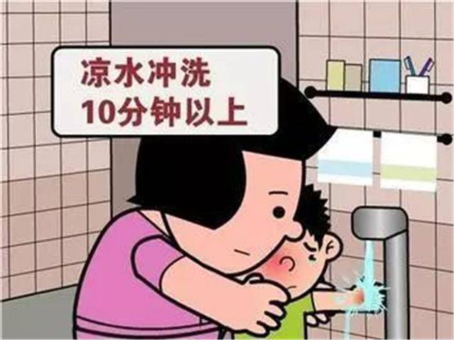 奶奶|奶奶冷静处理保住孩子双手，医生都点赞4岁孩子好奇伸手进油锅