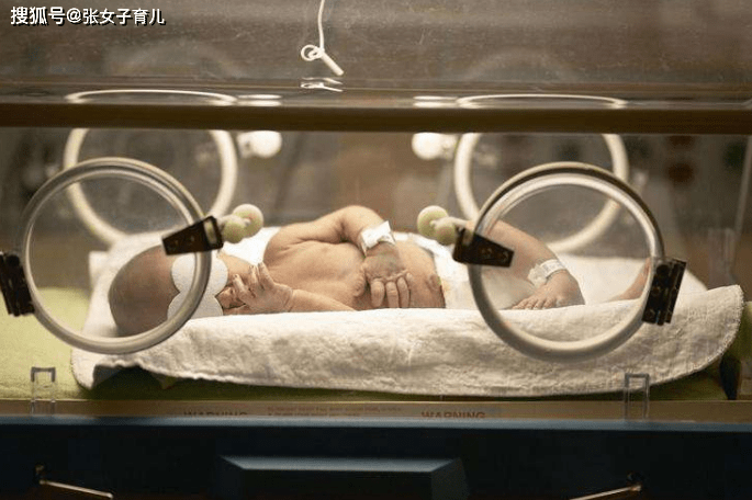 宝宝|是否就不能母乳喂养了呢？还真不一定的宝宝得了母乳性黄疸