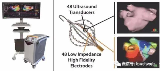Acutus|医疗企业Acutus Medical上市：市值6.6亿美元 专治心律不齐