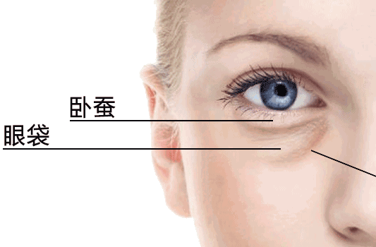 如何让眼睛快速恢复正常 8af730486f6b4ec1921a12a1090003c3.png