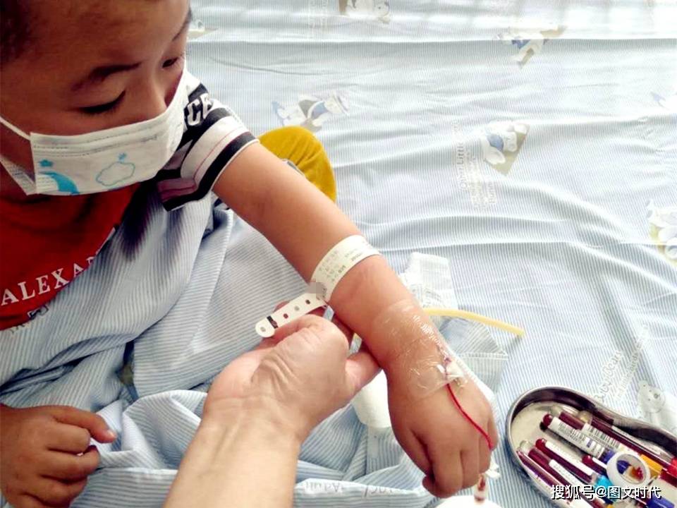 劫难|哥哥挺过来后被毁容,弟弟仍生死难料兄弟俩同在4岁遭劫难